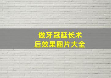 做牙冠延长术后效果图片大全