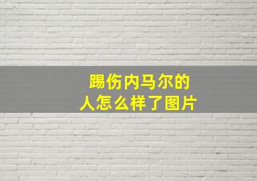 踢伤内马尔的人怎么样了图片