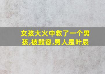 女孩大火中救了一个男孩,被毁容,男人是叶辰