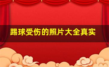 踢球受伤的照片大全真实